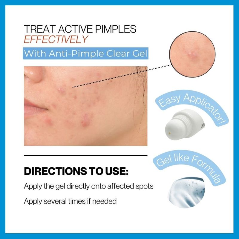 Sebamed Clear Face Anti-Pimple gel