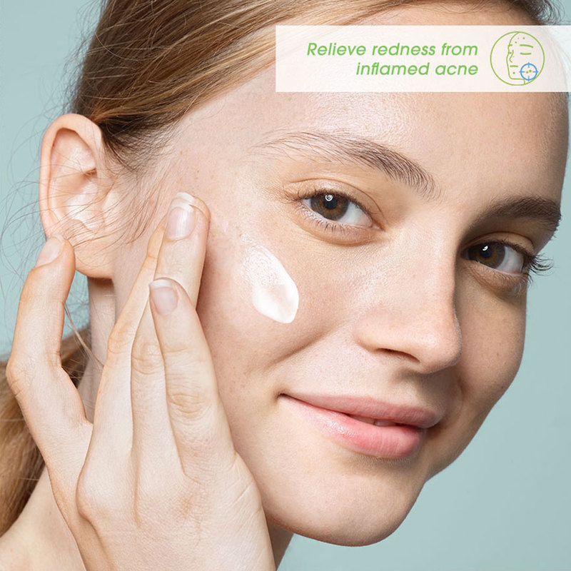 Bioderma Sebium Sensitive Soothing Acne Moisturiser (Acne-Prone Skin) 30ml